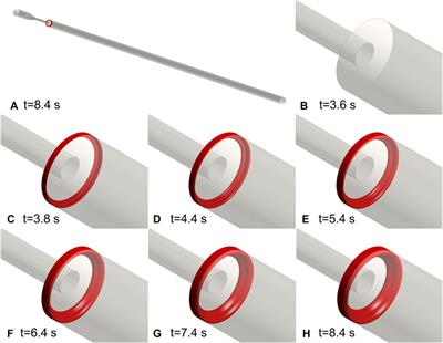 Computational Prediction of Thrombosis in Food and Drug Administration’s Benchmark <mark class="highlighted">Nozzle</mark>